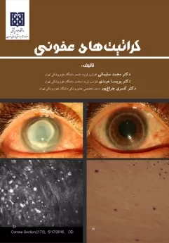 کتاب الکترونیک کراتیت های عفونی